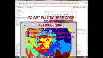 Noninvasive real time automated skin lesion segmentation matlab projects code