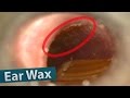#1 Ear Wax Removal  - Seki Edge Traditional Bamboo Ear Picks