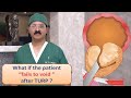 What if the patient fails to void after turp