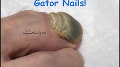 Gator Nail Nimbus, Onychogryphosis!?