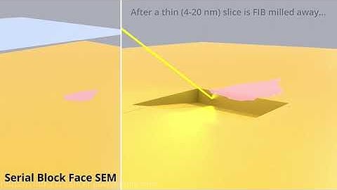 SBF SEM / FIB SEM (a Volume Electron Microscopy Technique).