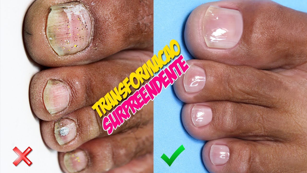 COMO FAZER UNHA DO PÉ (PEDICURE PERFEITO) YouTube COMO FAZER UNHA DO PÉ (PEDICURE PERFEITO) YouTube