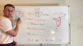 Ekg Series Left Ventricular Hypertrophy Criteria