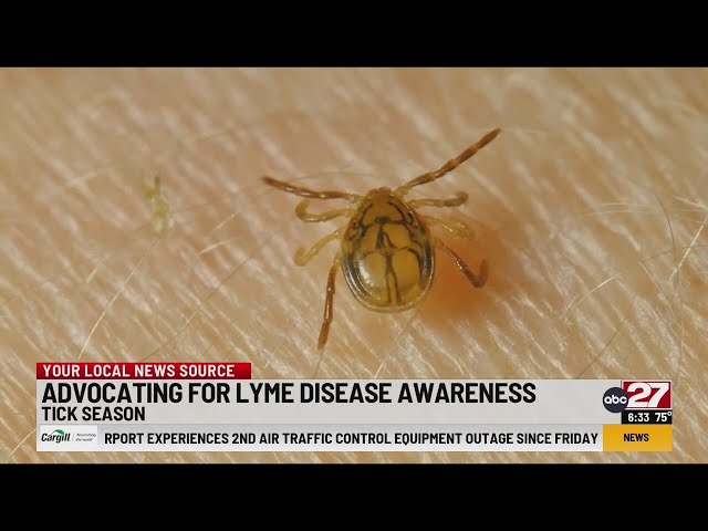 Advocating for Lyme disease prevention this 'tick season'