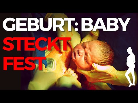 (2/2) Ärztin erklärt HelloCathis Geburtsbericht: was tun, wenn das Baby stecken bleibt? | Anahita