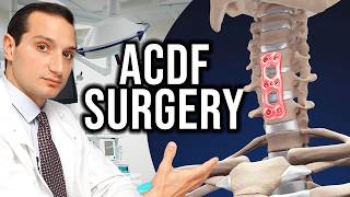 How ACDF Is Performed: 2 Different Patient Cases