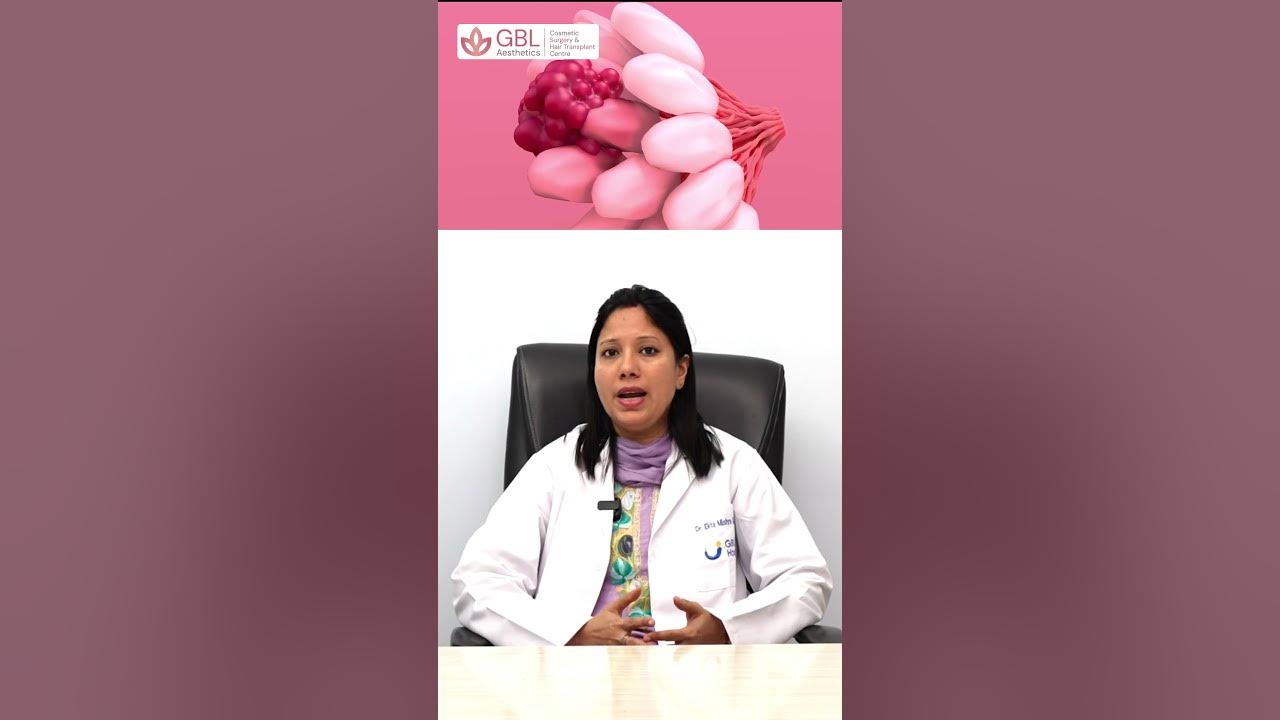 Do Breast Implants Cause Breast Cancer Dr Ekta Mishra Gautam GBL do-breast-implants-cause-breast-cancer-dr-ekta-mishra-gautam-gbl