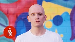 Hair Loss Made Him a Better Actor Actor Hair Loss