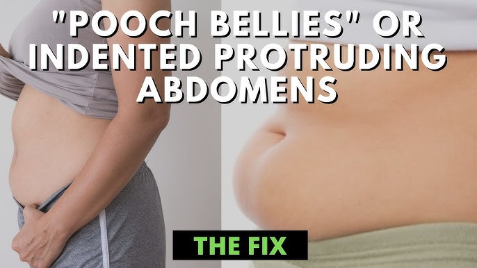 Why Your Protruding Belly Might Not Be Fat - The Fix 