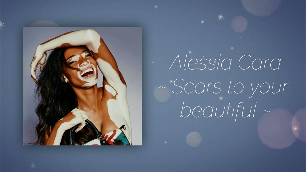 Alessia Cara Scars to your beautiful (but it