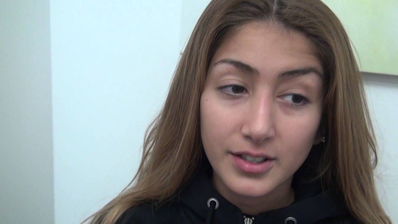 Näsplastik 10 efter 2 år Primakliniken plastikoperationer