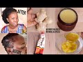 MIX GINGER & VIRGIN HAIR FERTILIZER TO GROW BALDNESS ALOPECIA AND SLOW GROWTH MASSIVELY FASTER