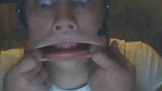 Re: Ugly Face Challenge - Upload Yours and Rate Others! Net Worth