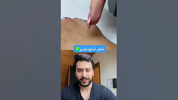 ازالة الشعر بالليزر دكتور يوسف 