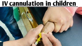 intravenous cannulaation in children ! बच्चों में आई वी कैनुला लगान सीखे