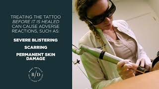 Exclusive The 8 Week Healing Process of Laser Tattoo Removal Profile