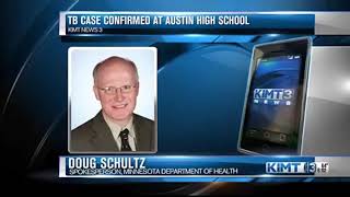 Case of TB Confirmed