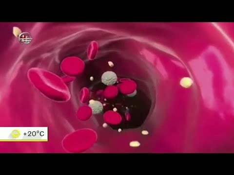 რა უნდა ვიცოდეთ აივ-შიდსით ინფიცირების პრევენციისთვის