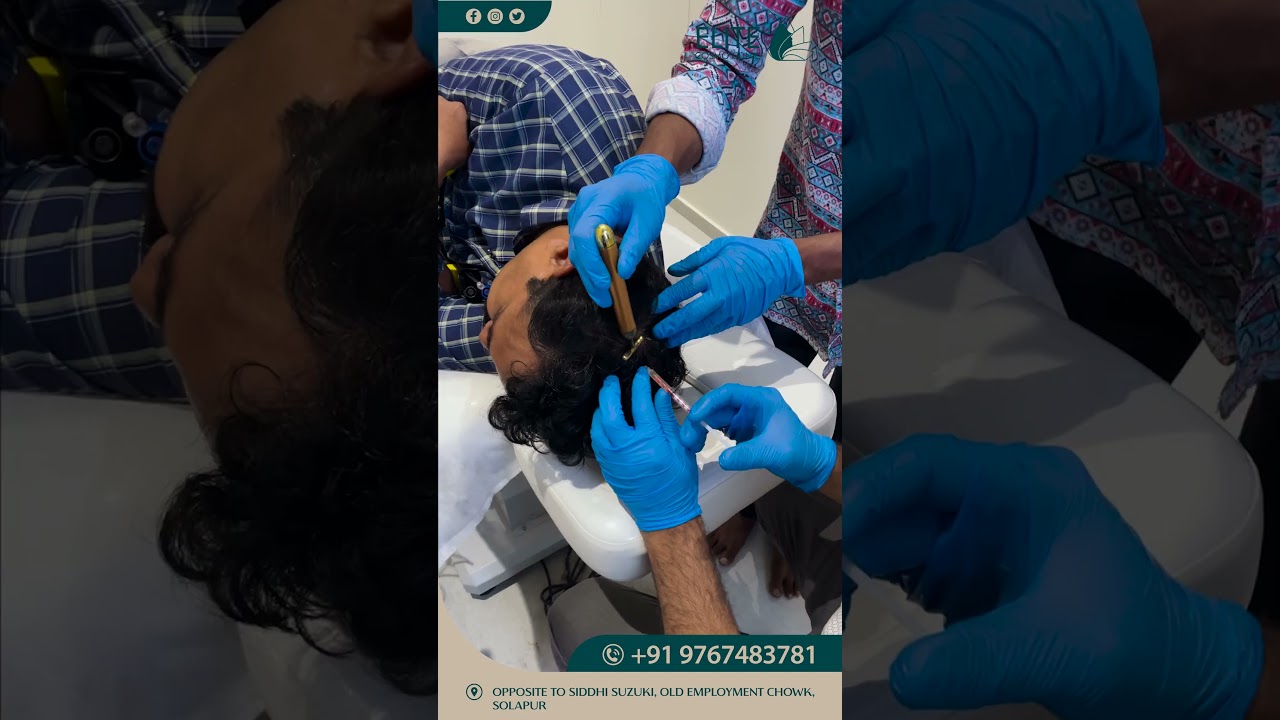 PRP Treatment