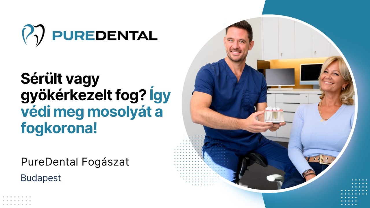Videó: így védi meg mosolyát a fogkorona – PureDental Budapest