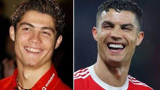 Cristiano Ronaldo Smile Transformation Before And After Famous Celebrity Teeth Before & After