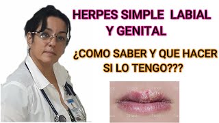 HERPES SIMPLE VIRAL , LABIAL Y GENITAL ,COMO SABER Y QUE HACER SI LO TENGO?