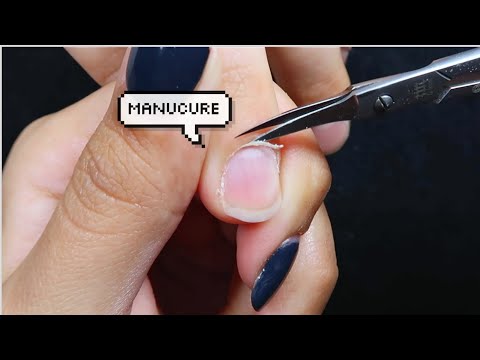 Vidéo: La façon la plus simple de faire un traitement des ongles