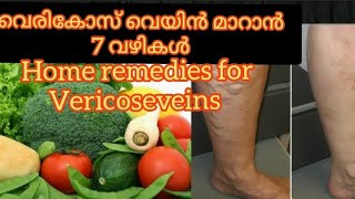 #spiderveins #vericoseveins  home remedies/vericodeveins malayalam/treatment