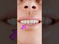 Stop Brushing Your Teeth Here’s What Happens!