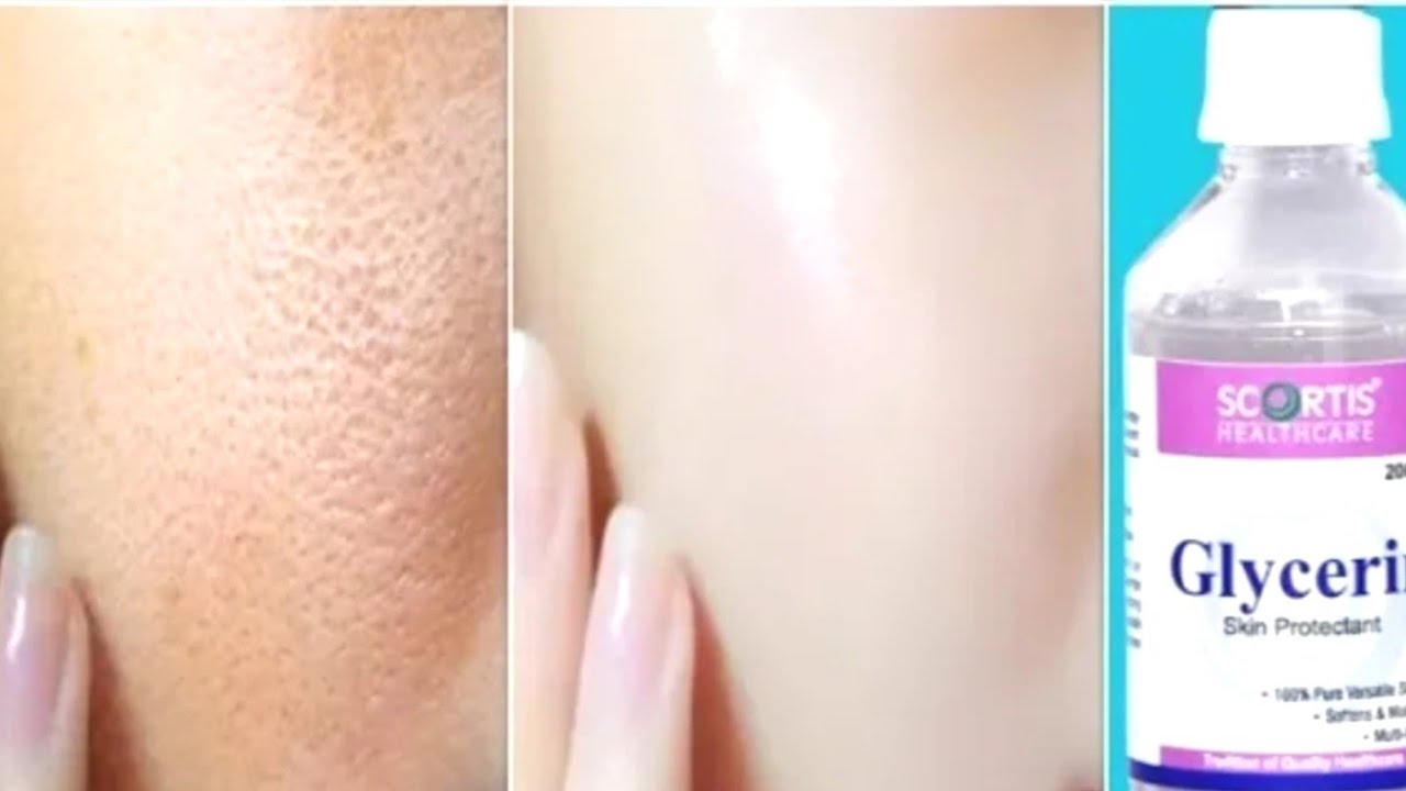 Miracles of Glycerin|Tara Care|Beauty Tips In Tamil - YouTube