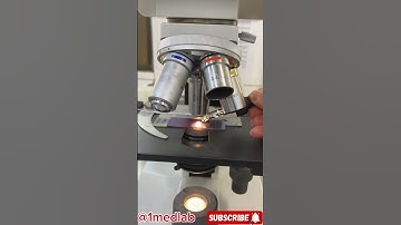 Leukemia cells as seen under a microscope