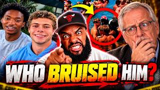 They Found Nolan Wells With 2 Mysterious Bruises