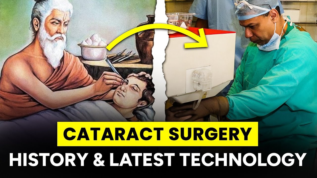 The Evolution and Latest Technology in Cataract Surgery - YouTube