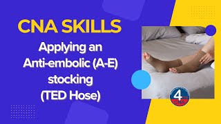 CNA Skills: Applying Ted Hose with testing checkpoints!