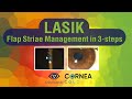 Cornea colours  lasik flap striae management in 3steps