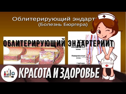 Облитерирующий эндартериит
