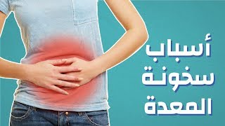 أسباب سخونة المعدة #موضوع