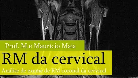Para que serve ressonância da coluna cervical?