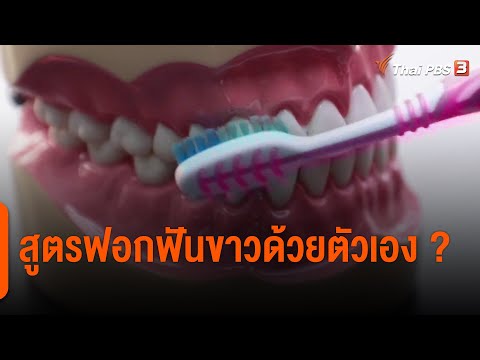 วีดีโอ: วิธีทำให้ฟันขาวด้วยไฮโดรเจนเปอร์ออกไซด์: 9 ขั้นตอน