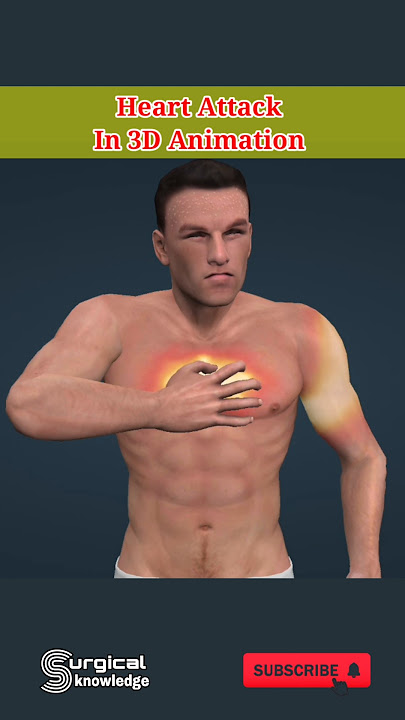 Heart Attack in 3D Animation #heartattack #animation #anatomy #medical