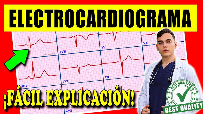 Electrocardiógrafo Portátil de 3 canales con Impresora térmica ECG300G -  Logarsalud