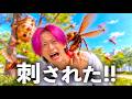 巨大なハチに刺され病院に運ばれました。その後まさかの結末に。【コント】
