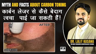 MYTH AND FACTS ABOUT CARBON TONING BY DR. LALIT KASANAS