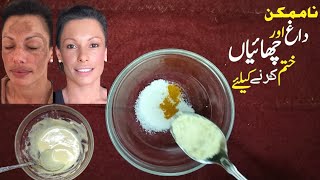 pigmentation treatment at home | chehre ki Chaiyan khtam Karne ka tarika