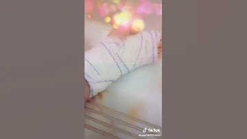 شوفو يد سمر كلش مجروح من امير نبيل هي كلش تموت على امير نبيل هوية من هاذا هي مجروح 