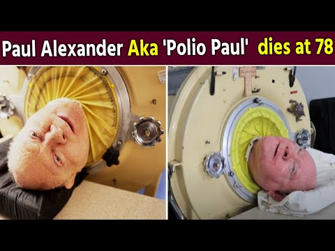 Paul Alexander, &#39;Polio Paul,&#39; passes away at 78 after spending 70 years in iron lung | FilmiBeat