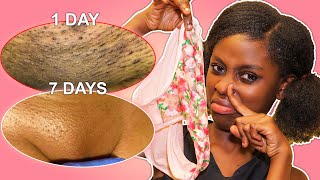 Ondoa VIPELE Sehemu za Siri Na WEUSI Kwa BIBI | Get rid of Ingrown Hair & Razor Bumps from Shaving screenshot 4