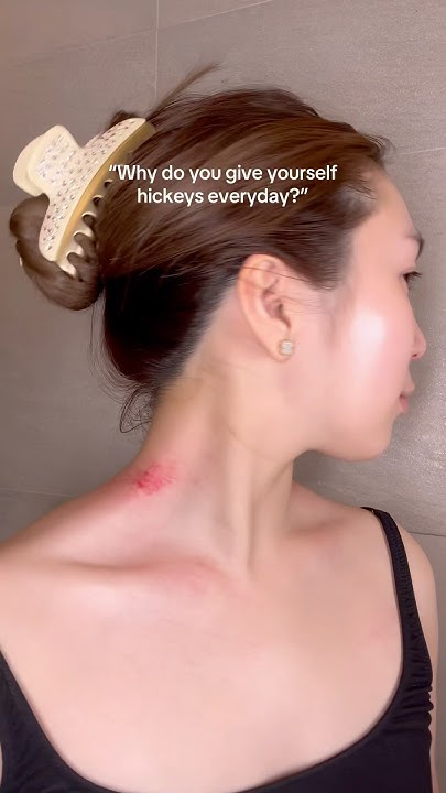 Why Do You Give Yourself Hickeys YouTube why-do-you-give-yourself-hickeys-youtube