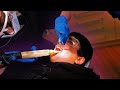 Tooth Extraction Vlog: Brother gets teeth out