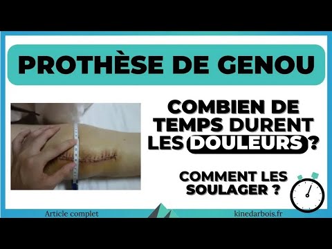 Vidéo: Comment gérer la douleur après une chirurgie de remplacement du genou : 11 étapes